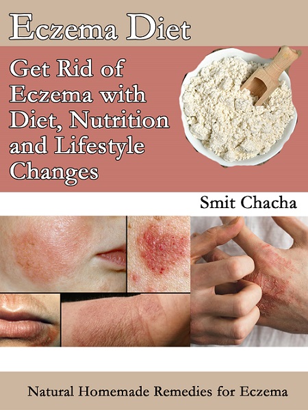 Eczema Diet Book